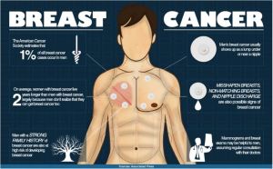 Male-Breast-Cancer-1